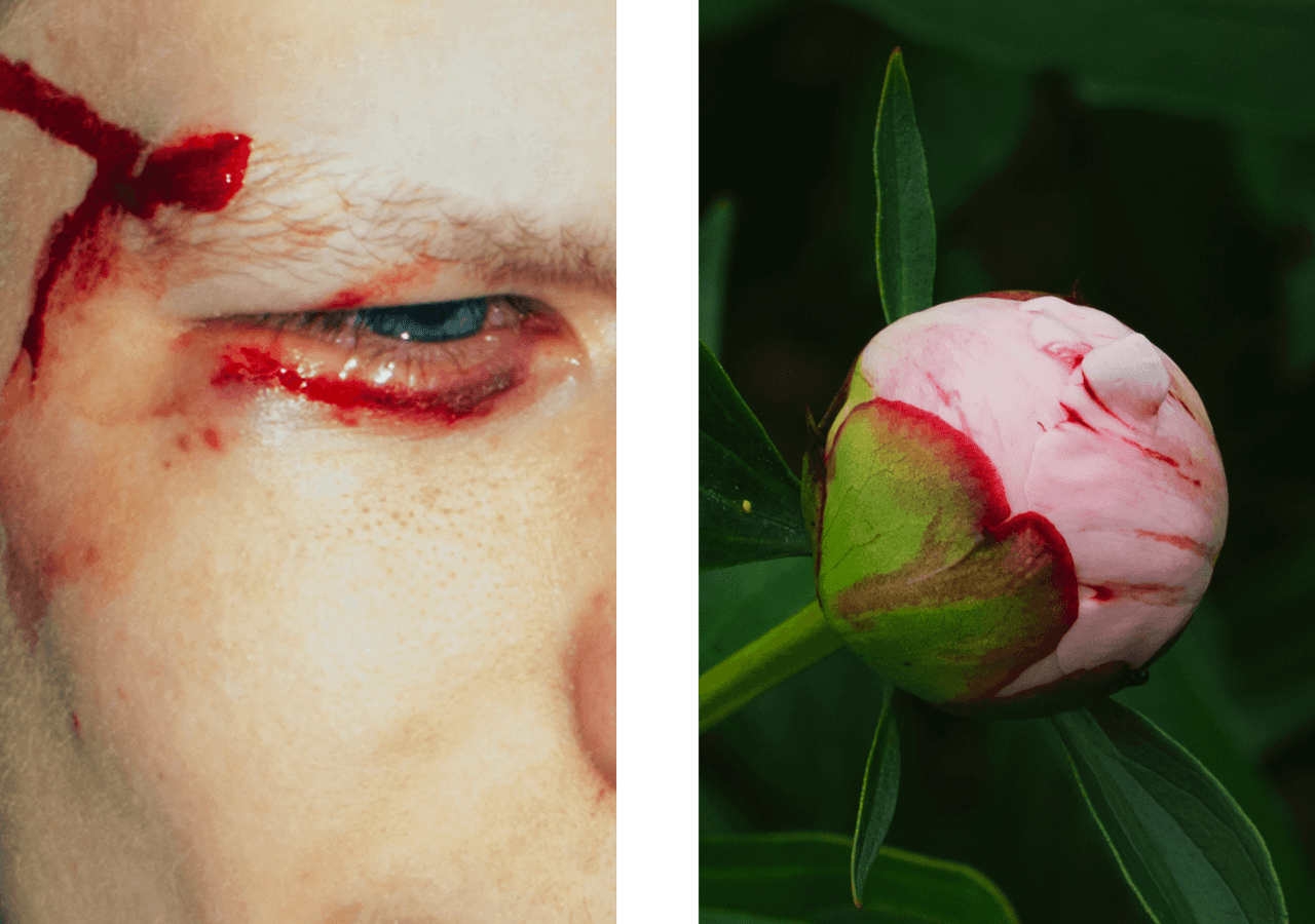 A bloody cut above and below someone's eye paired with a pink and red flower.