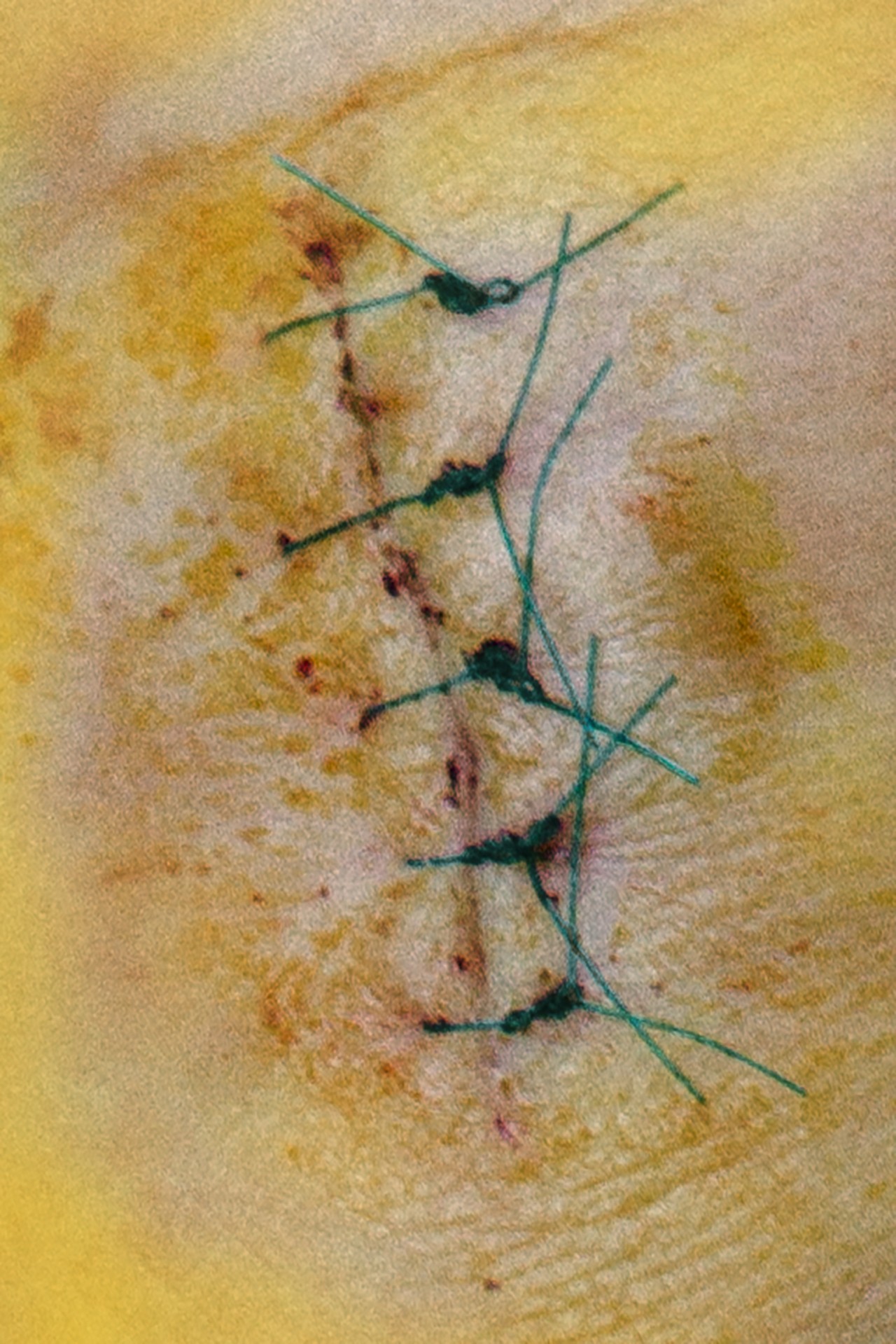 Riley Black on the Joy of Bruises