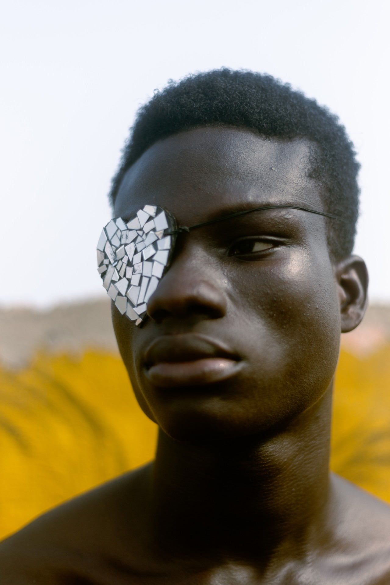 A young man wearing an eyepatch in the shape of a heart looks away from the camera