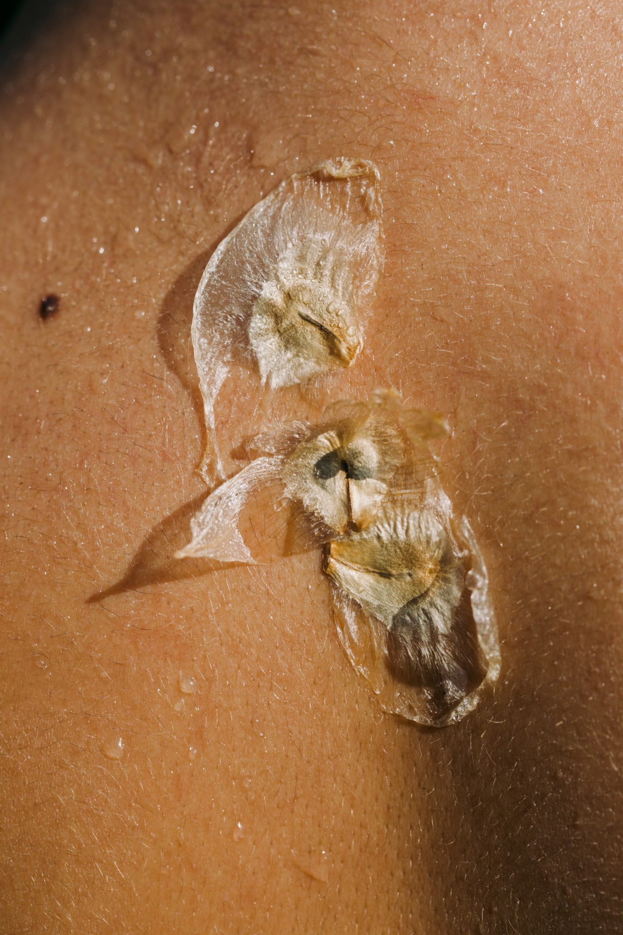 A partially crushed flower sticks to the skin of a person.
