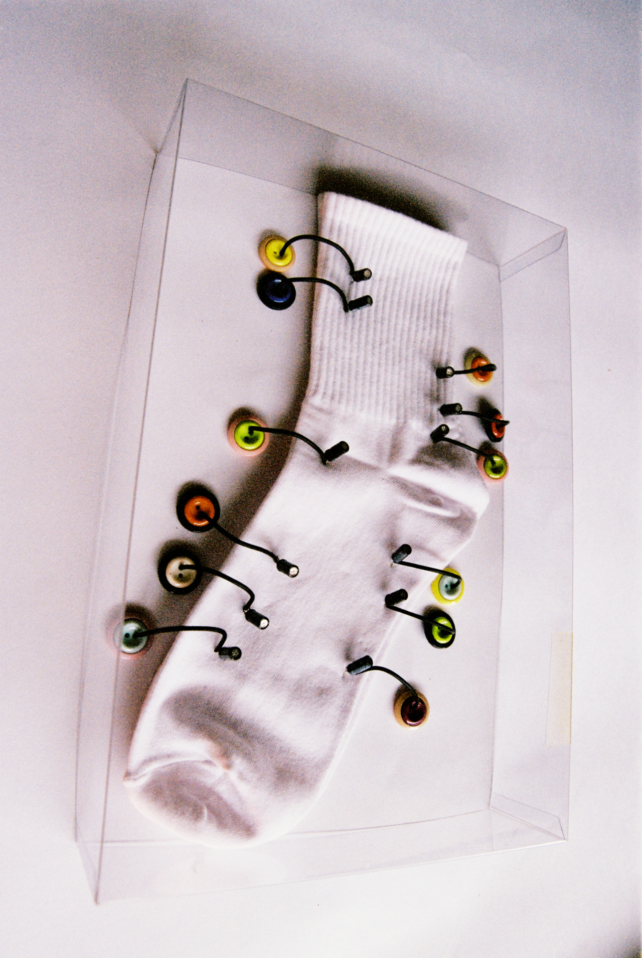 A white sock surrounded by pins in a glass case.